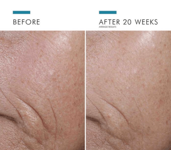Advanced Vitamin C Serum with Ferulic Acid befor and after effects